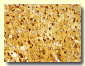 Panfocal of CB in Cortex 2
